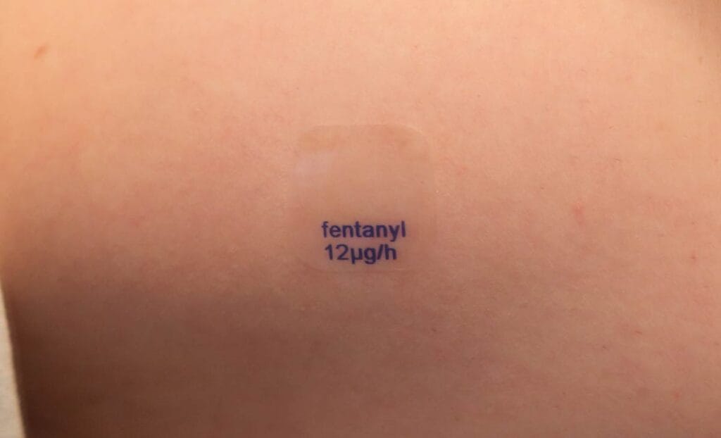 Image of an arm with fentanyl patch administering a safe dose of the drug