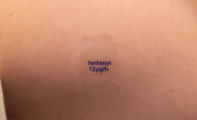 Using Fentanyl Patches to Address Vancouver’s Overdose Epidemic